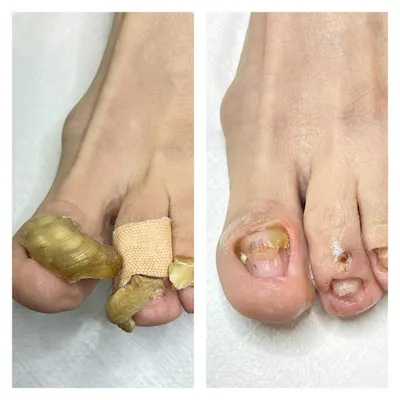 Camillen60 - Centrum Podologii - Sklep, Szkolenia, Podolog - Poznań